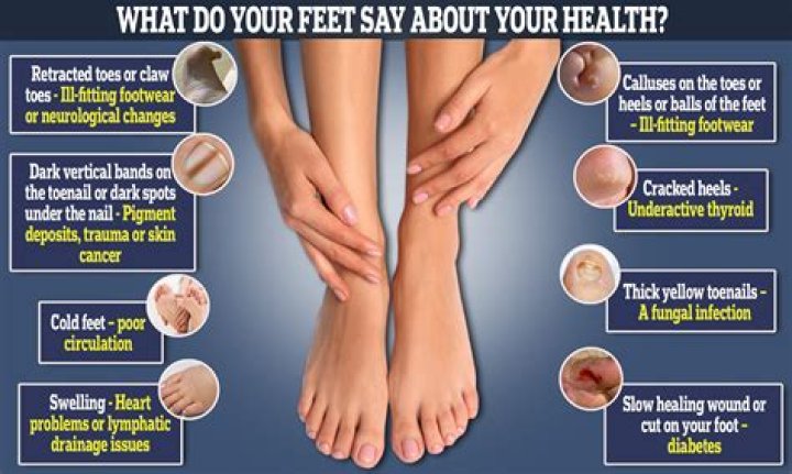 Are Sandals Bad for Your Feet? Sadly, the Answer is Yes
